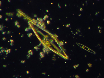microscopio.-